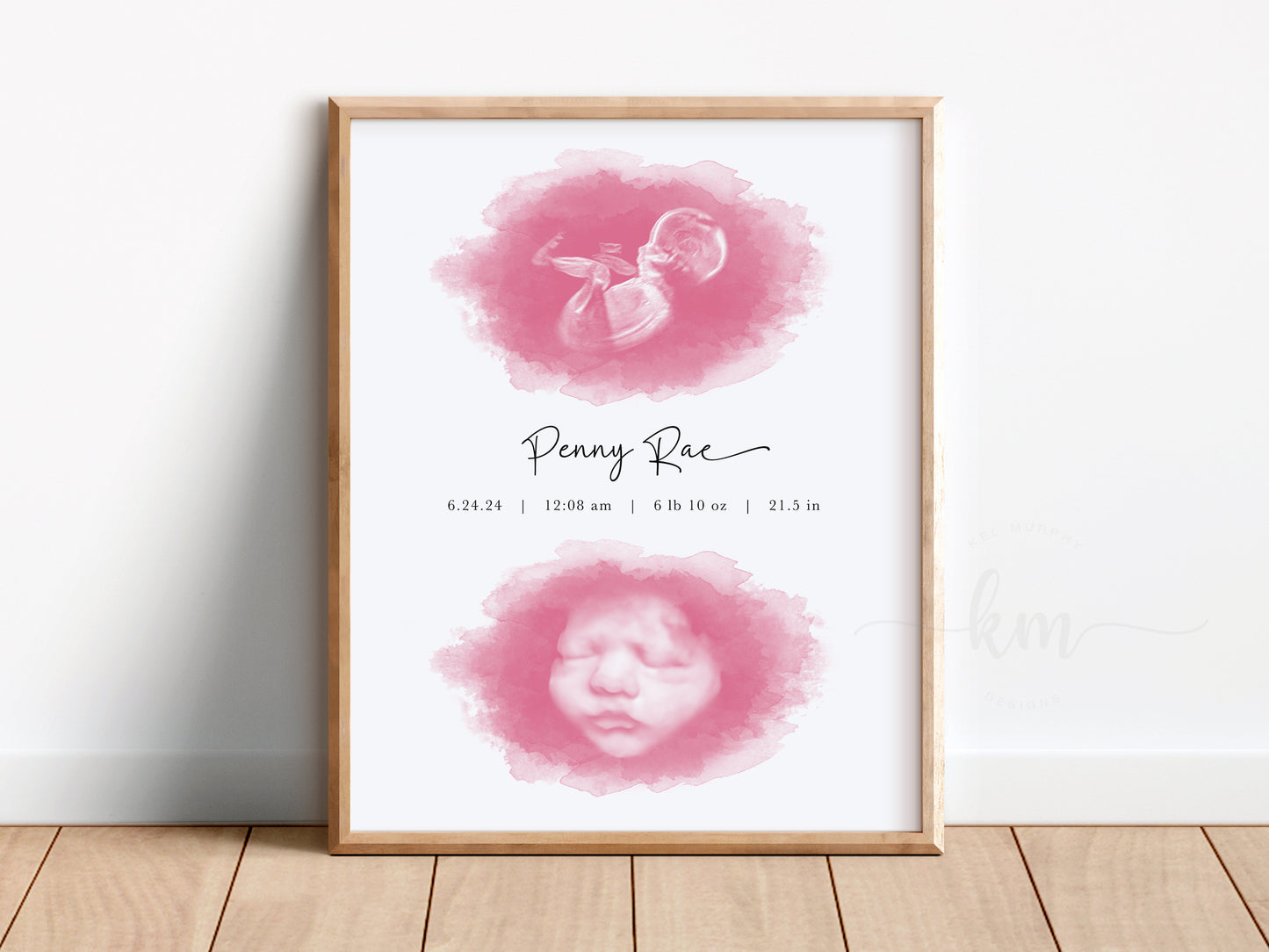 Two ovals watercolor ultrasound art for twins – baby loss or baby shower gift