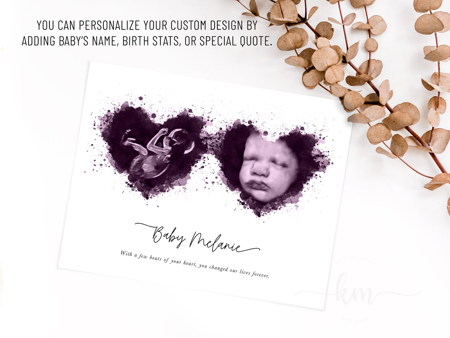 Custom twin ultrasound print with watercolor heart design for memorial or celebration