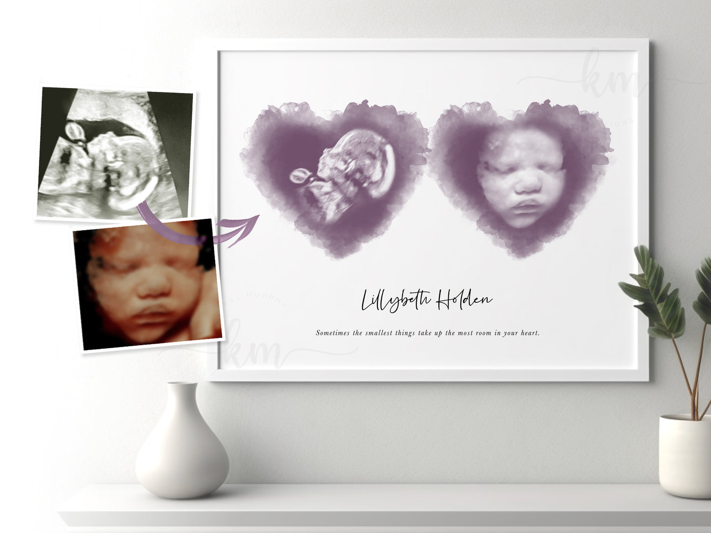 Personalized two-heart ultrasound print for baby loss or new mom gift