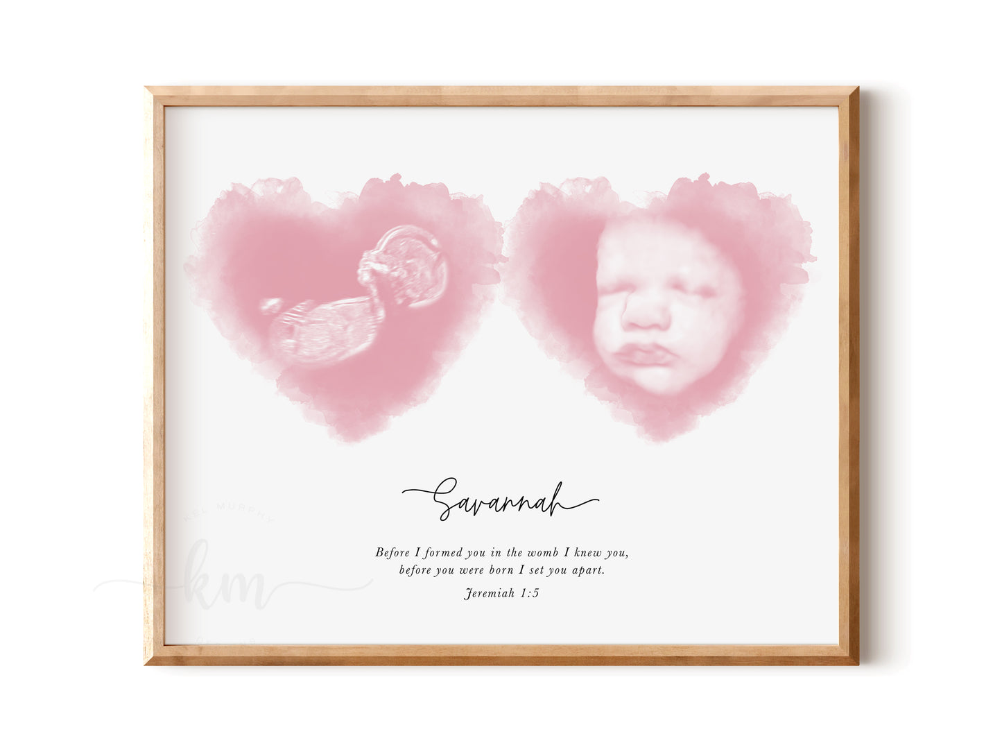 Custom twin ultrasound artwork with baby names and special text