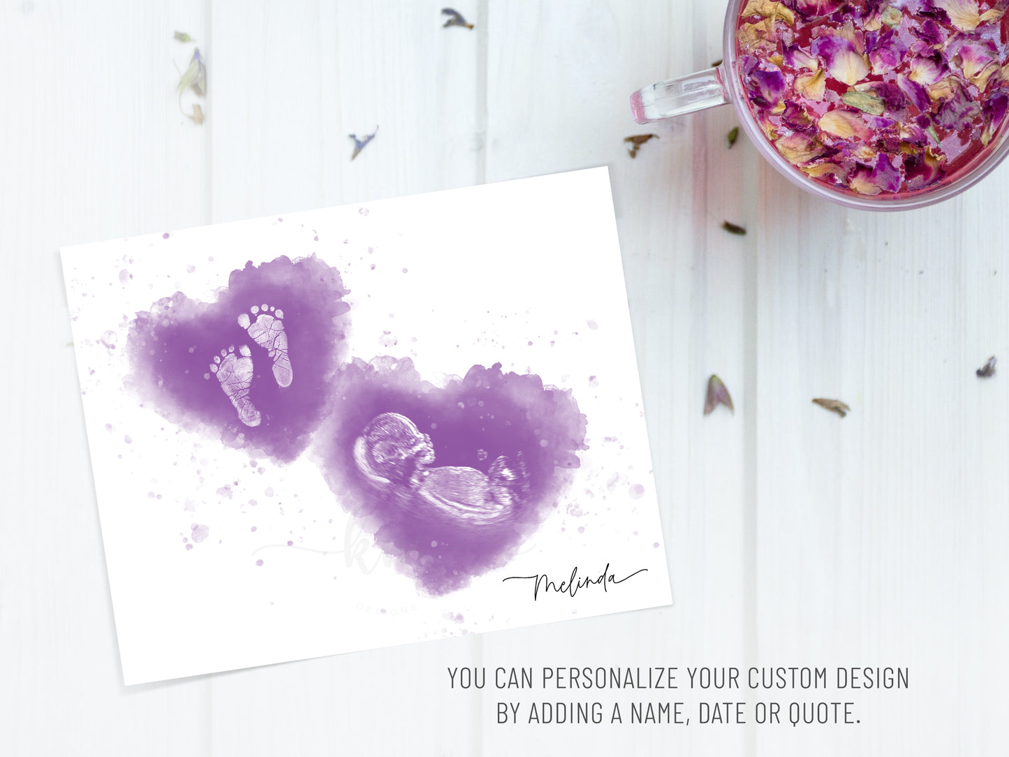 Memorial or baby shower art featuring baby’s ultrasound and personalized name with prints