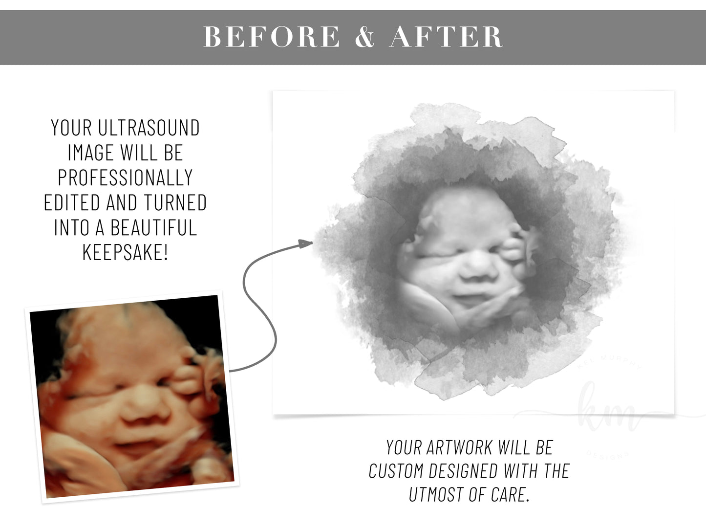 Baby Shower Guestbook Art with Watercolor Ultrasound