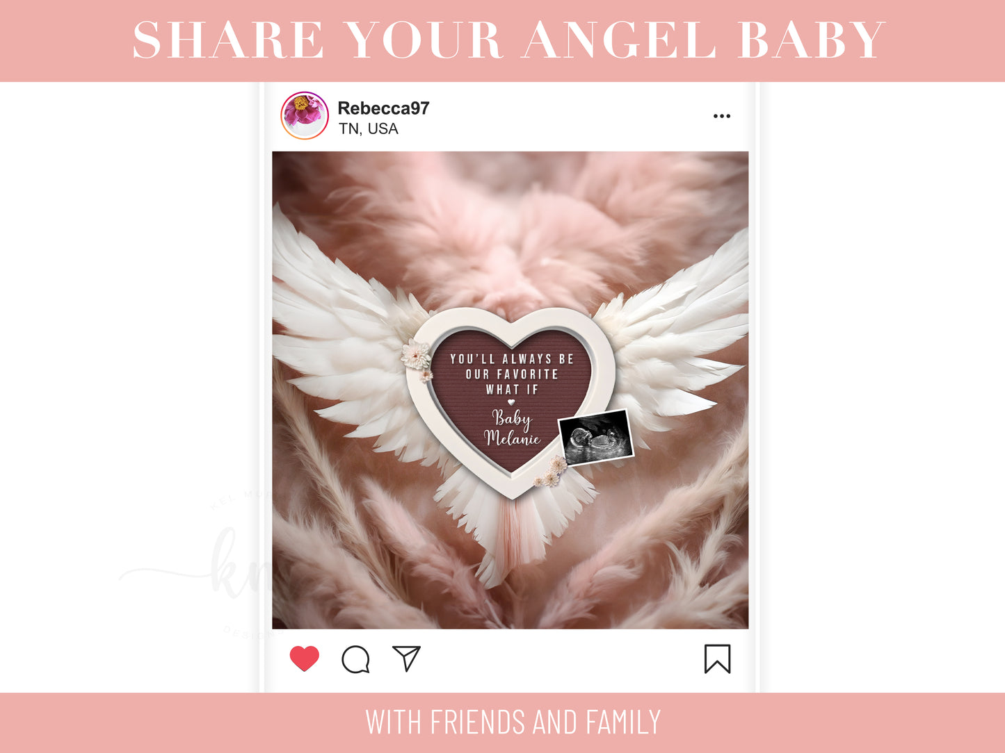 Personalized baby loss announcement featuring ultrasound and custom wording for remembrance