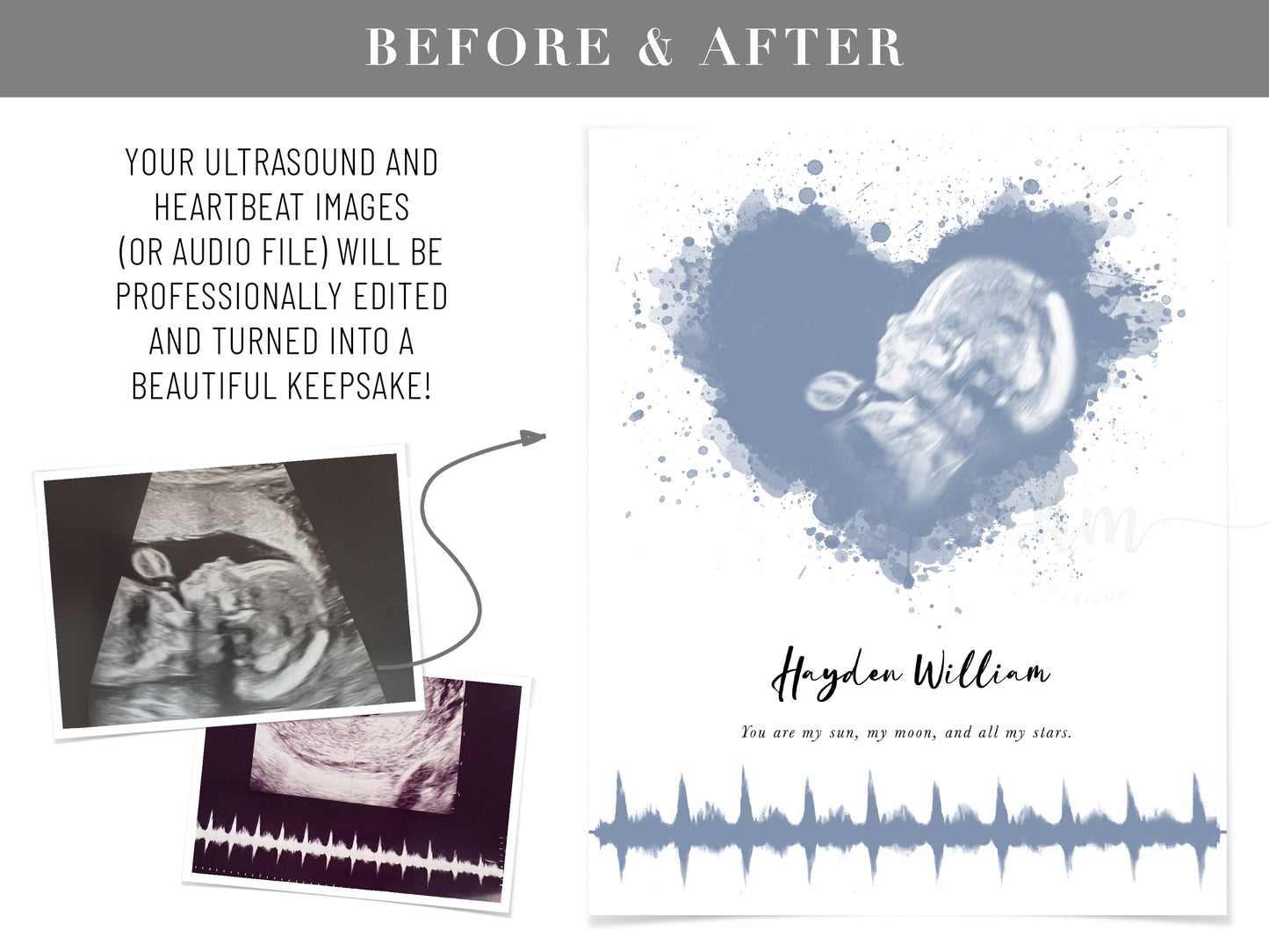 Custom framed ultrasound keepsake with soundwave for new mom or pregnancy loss gift