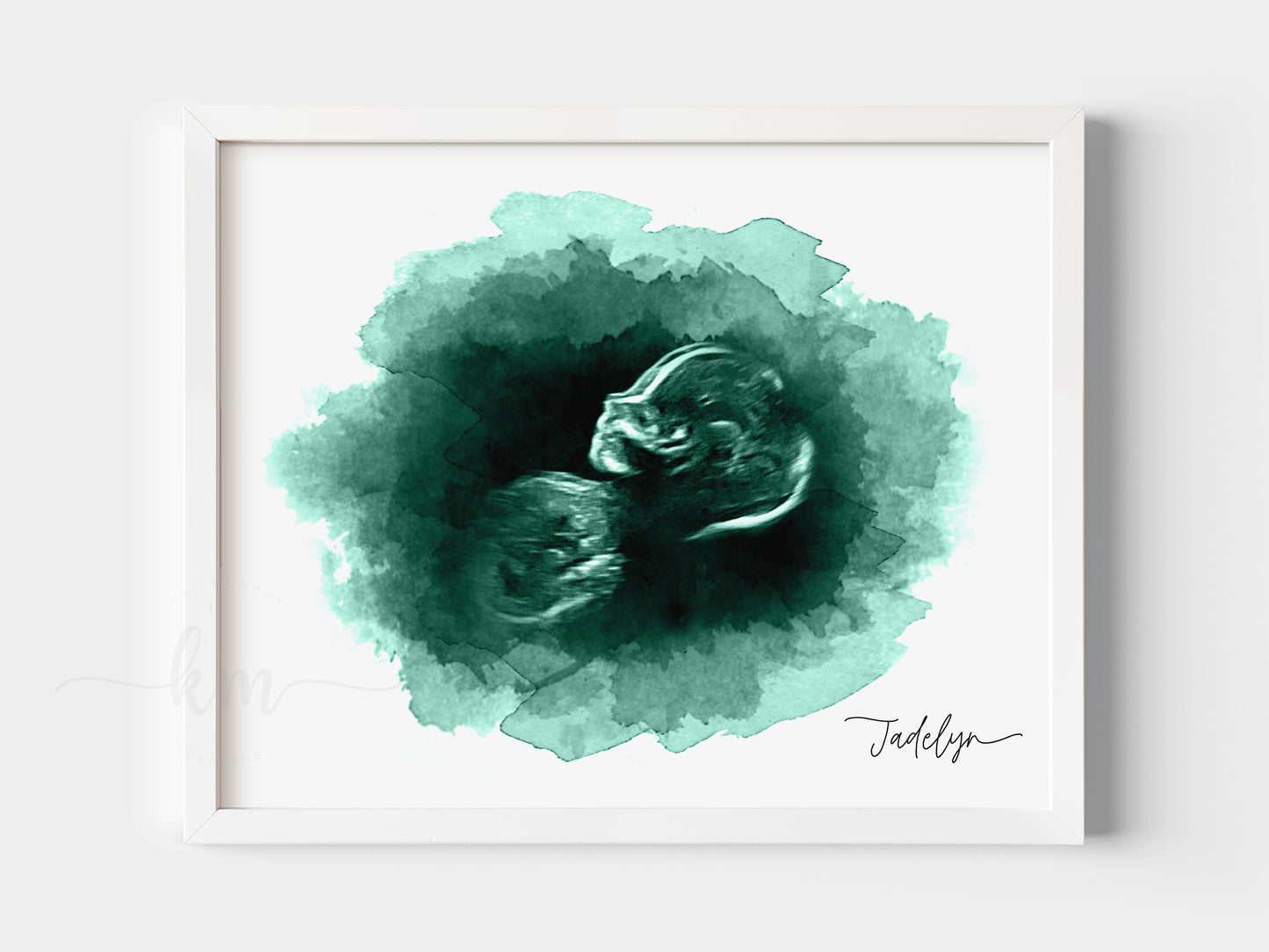 Custom ultrasound artwork with oval watercolor design