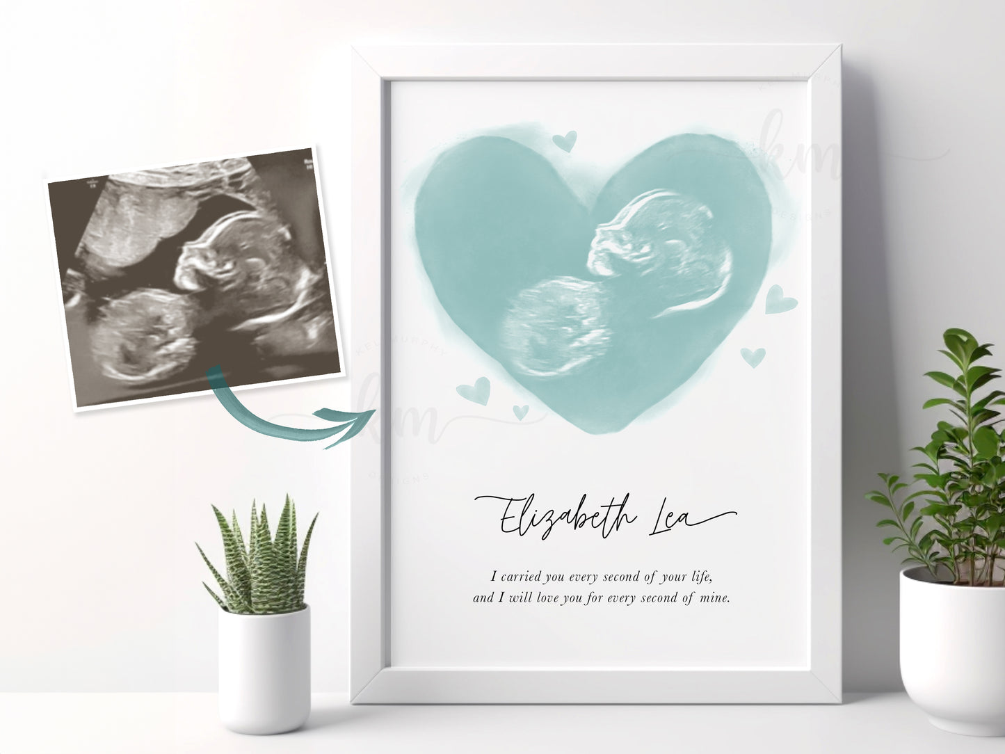Hearts Watercolor Ultrasound Art
