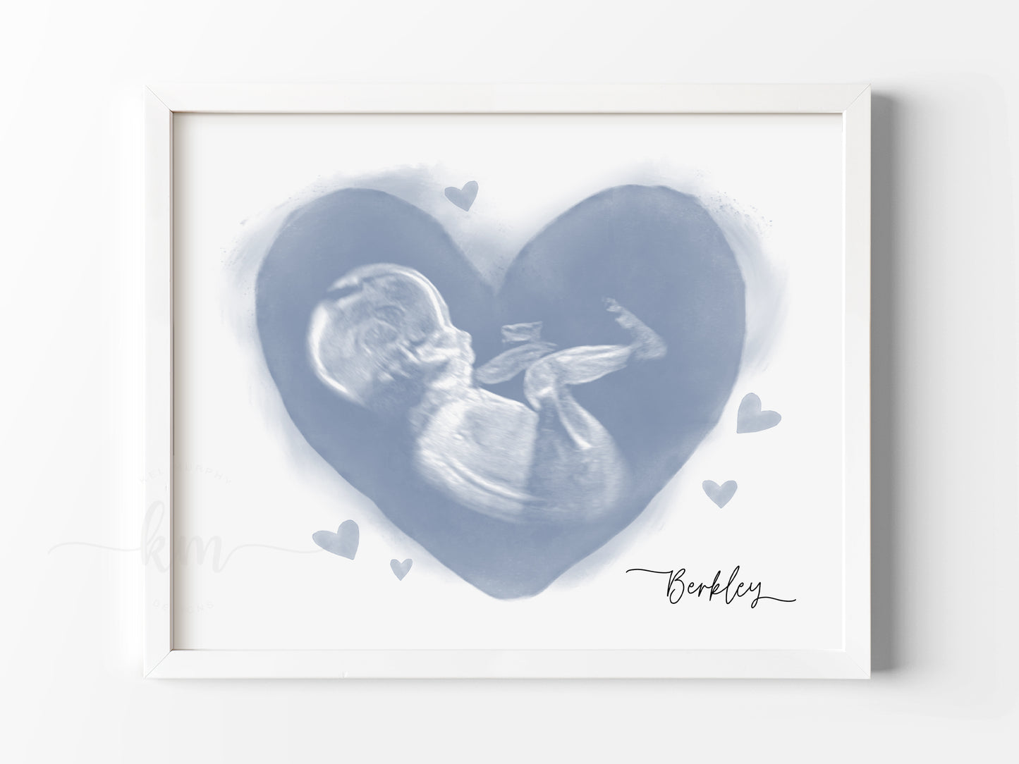 Hearts Watercolor Ultrasound Art