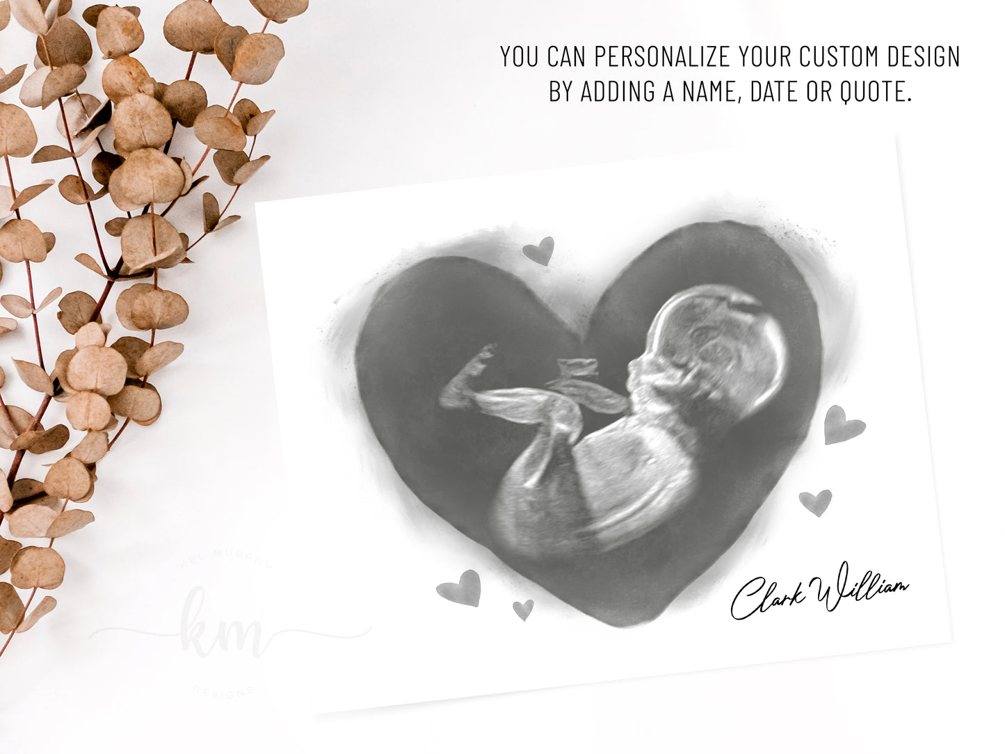 Hearts Watercolor Ultrasound Art