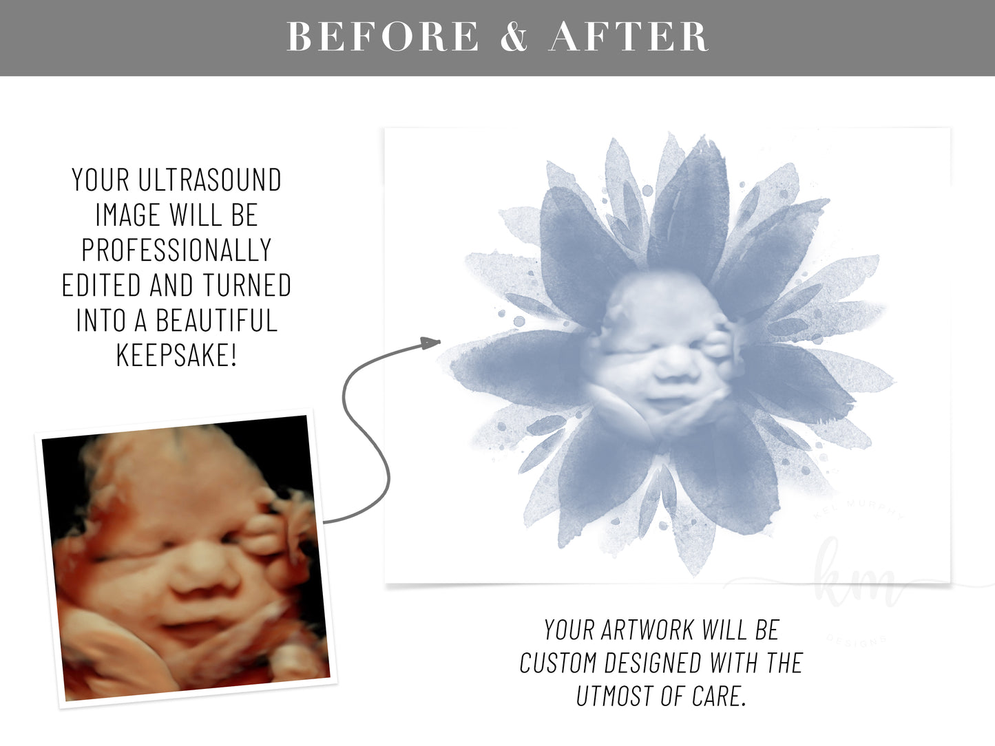 Baby Shower Guestbook Art with Flower Watercolor Ultrasound