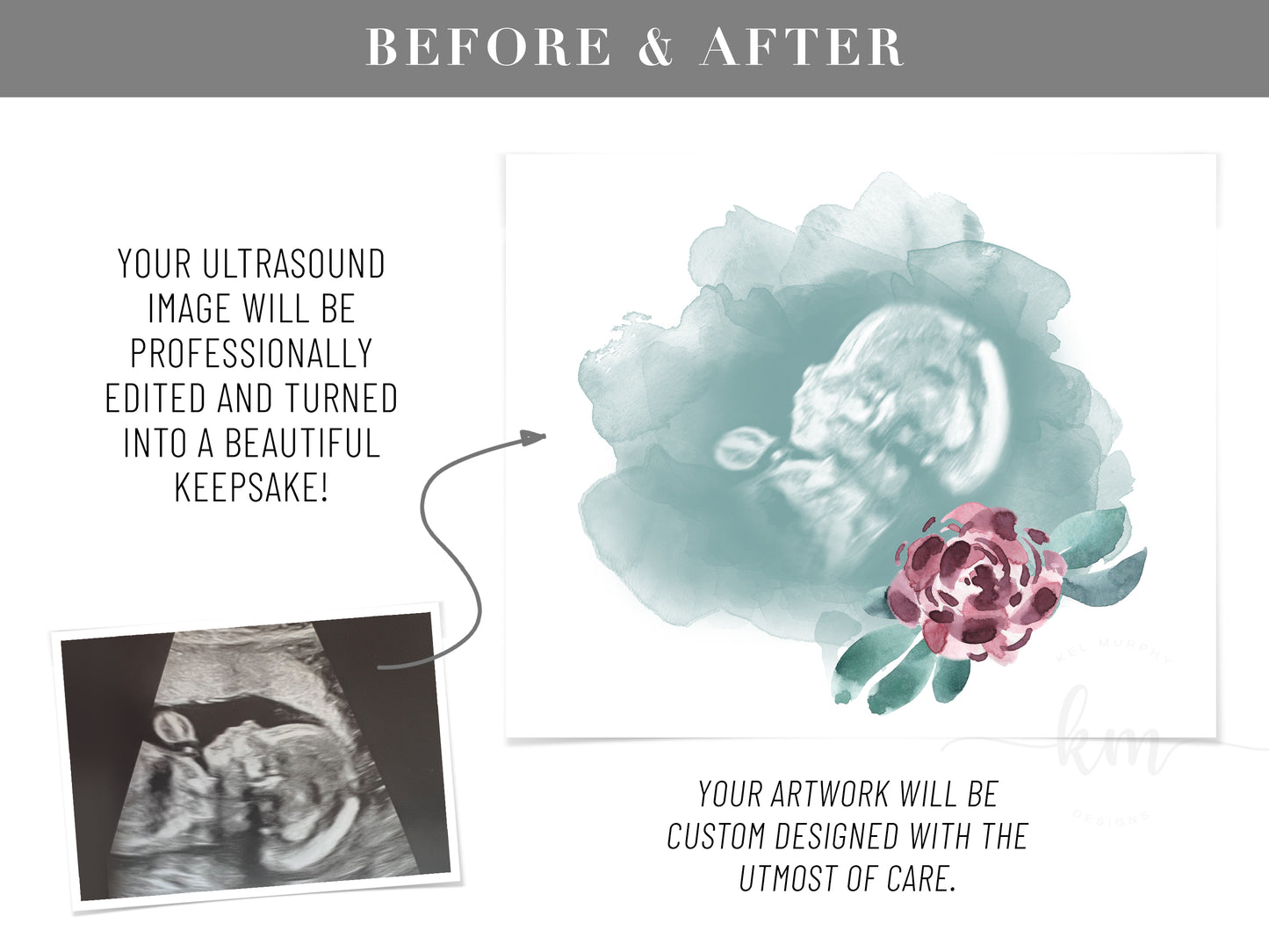 Watercolor flower ultrasound art as a meaningful miscarriage remembrance gift