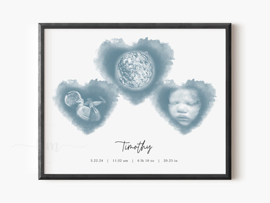 IVF embryo and ultrasound art with three hearts in a pyramid layout – personalized baby loss memorial or baby shower gift