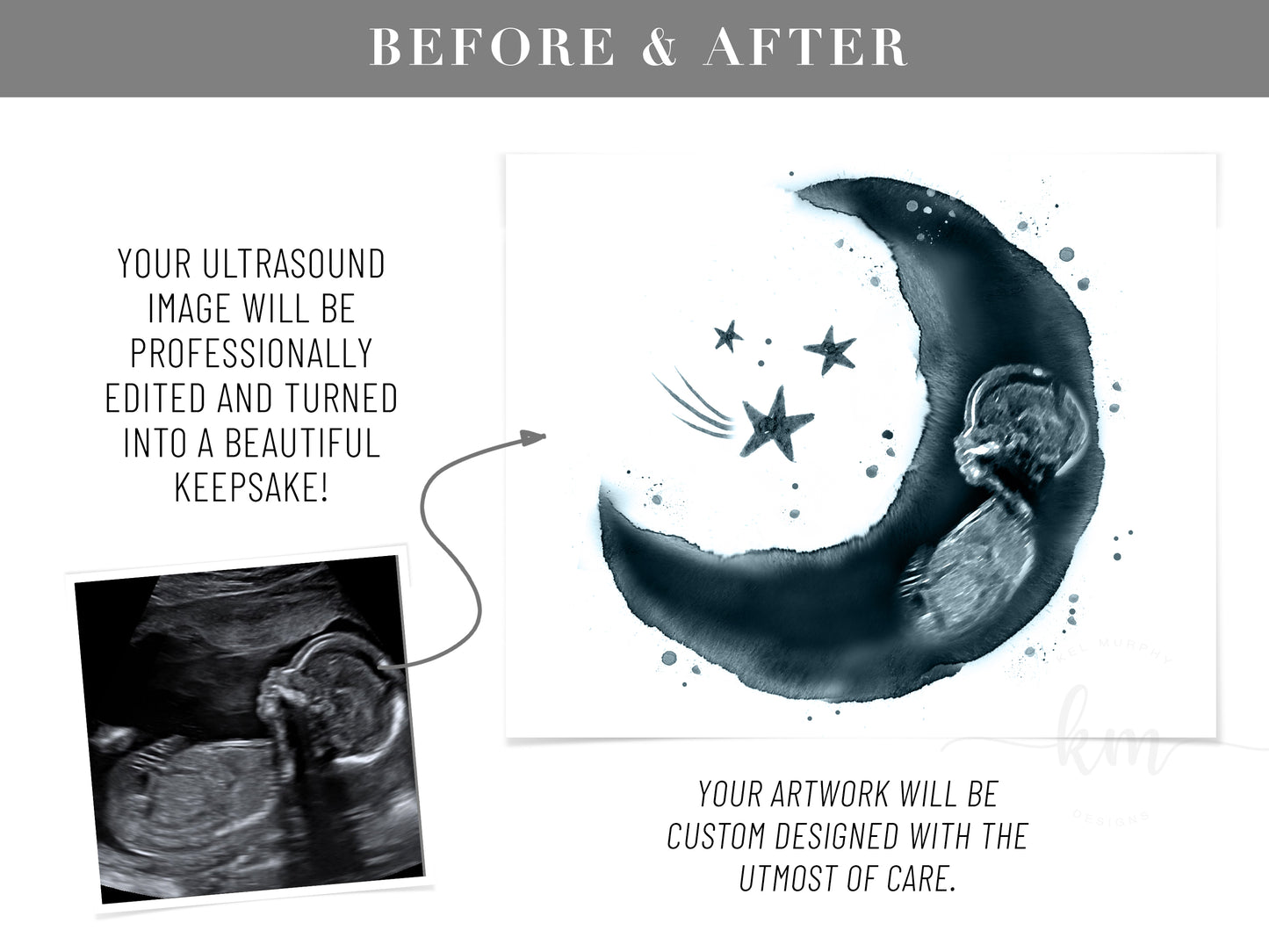 Baby Shower Guestbook Art with Moon Ultrasound