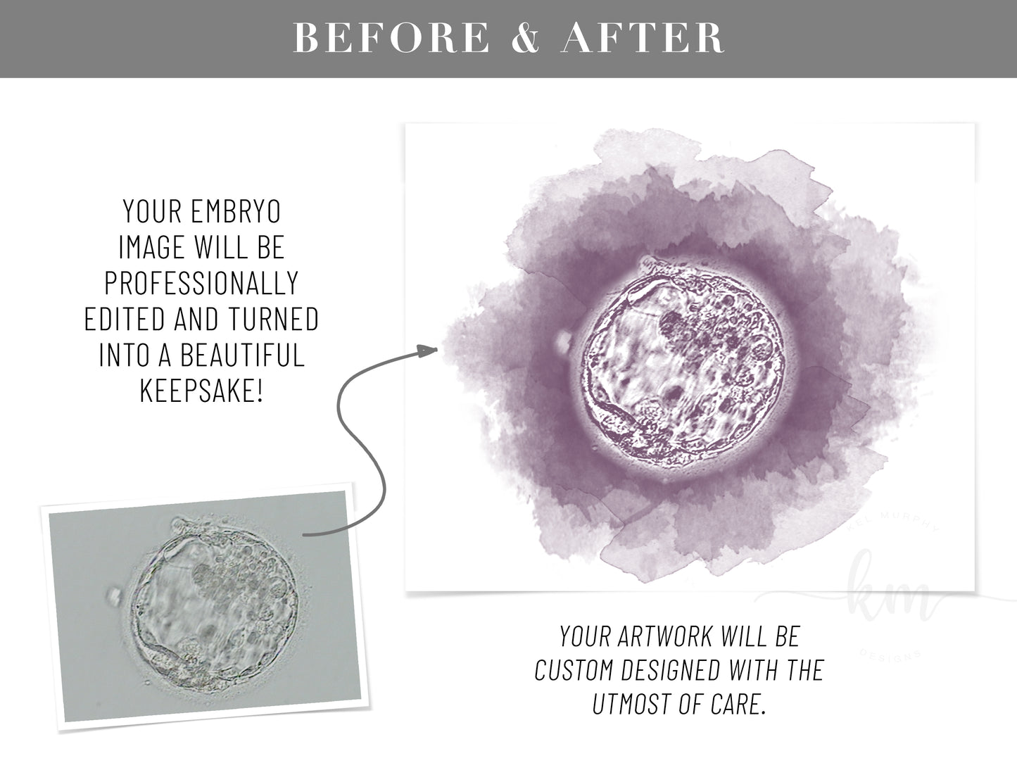 Custom watercolor embryo print for honoring pregnancy loss