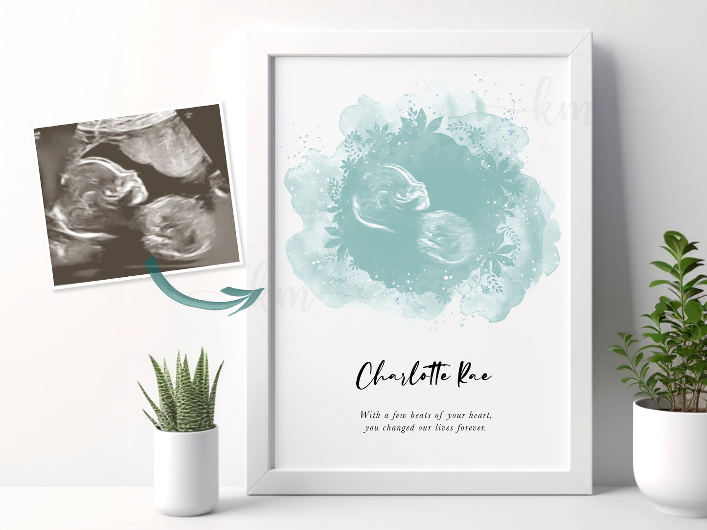 Baby shower or memorial gift featuring floral watercolor ultrasound artwork