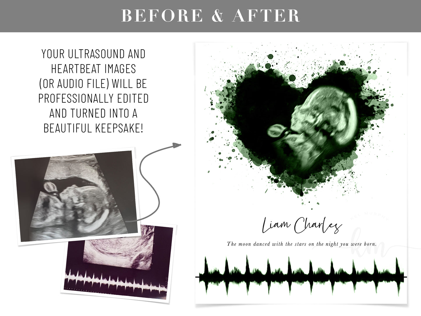Custom ultrasound keepsake featuring splatter heart design and heartbeat soundwave for baby memorial