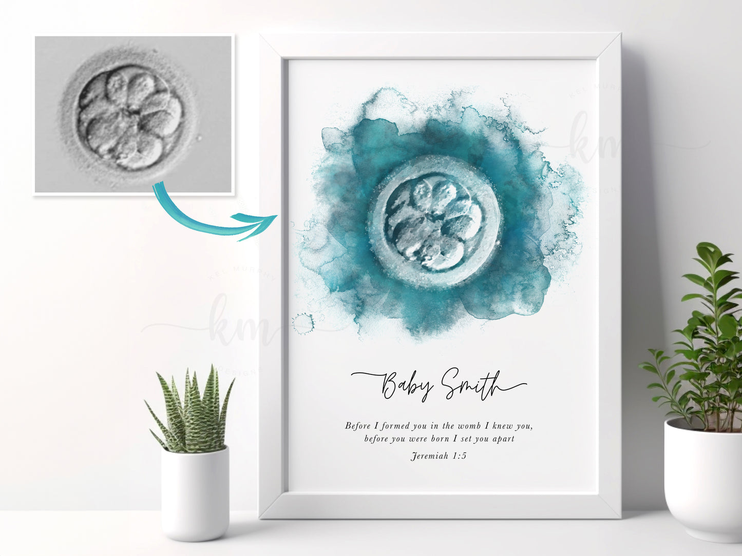 Hand-Painted Watercolor IVF Embryo Art