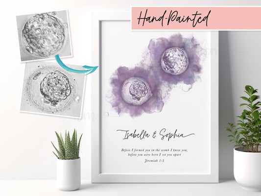 Hand-painted IVF twins embryo art with watercolor design – personalized baby loss or fertility keepsake