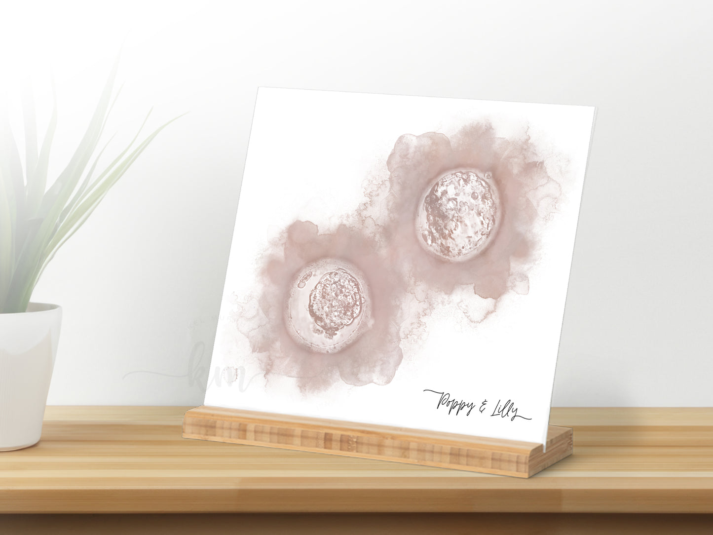 Hand-Painted Watercolor Twins IVF Embryo Art