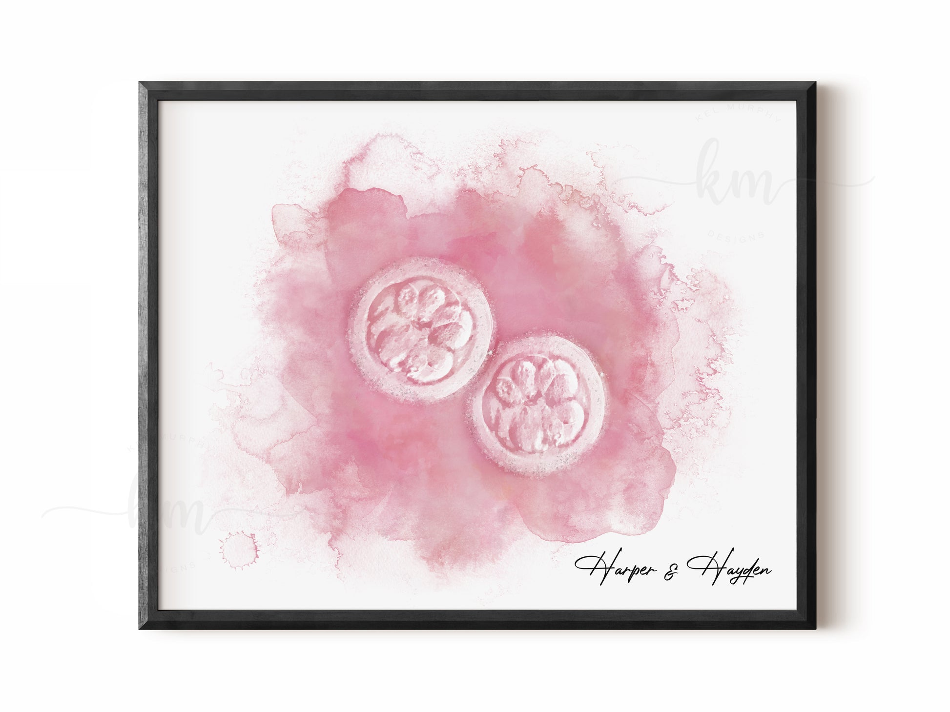 Embryo tribute artwork created from IVF image – beautiful memorial or pregnancy keepsake