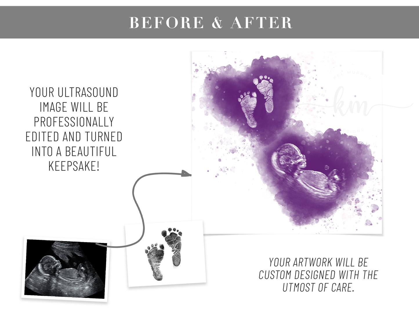 Vertical watercolor keepsake with ultrasound and baby prints – pregnancy loss or new mom gift