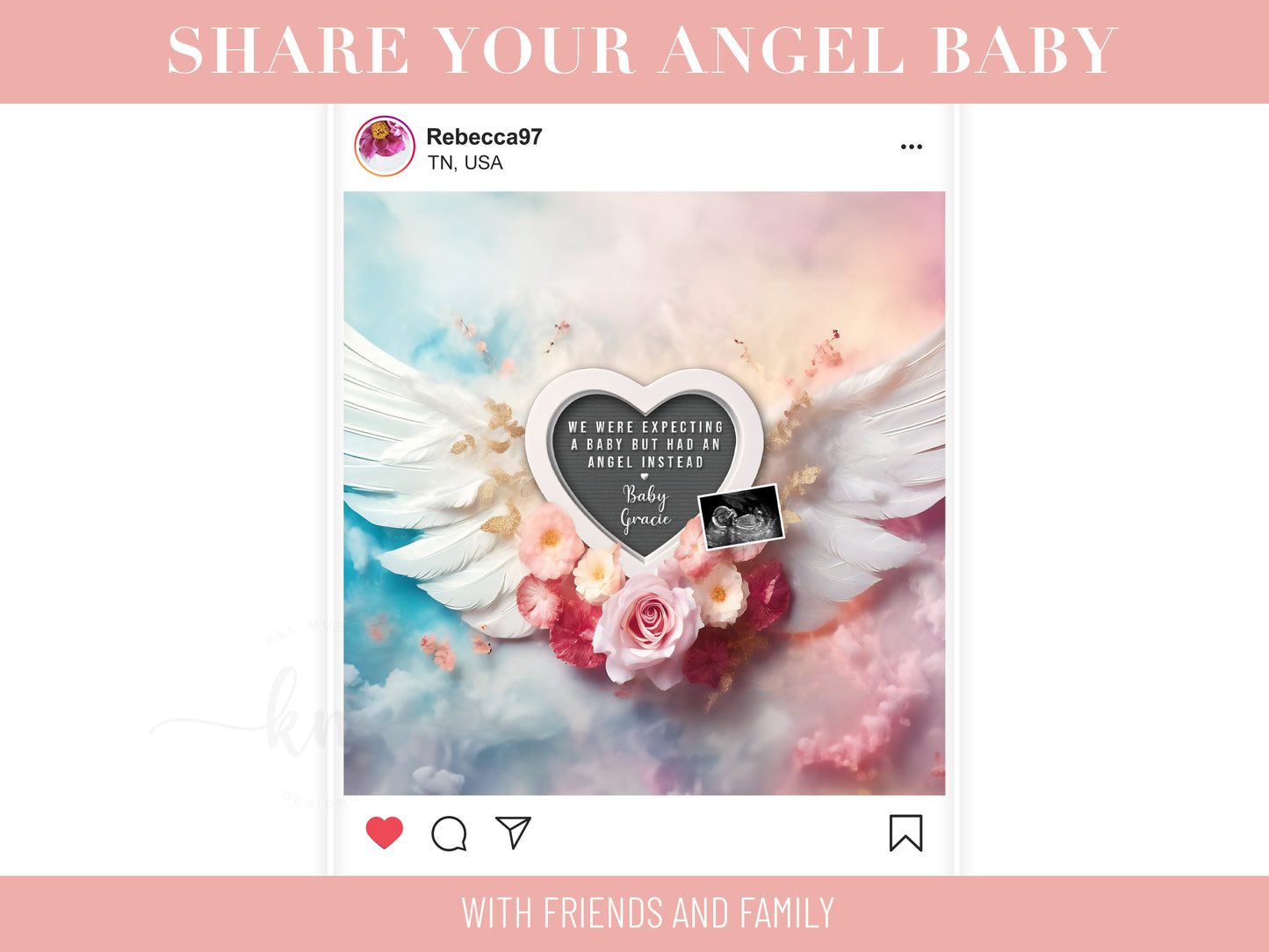 Personalized baby loss announcement featuring ultrasound and custom wording for remembrance