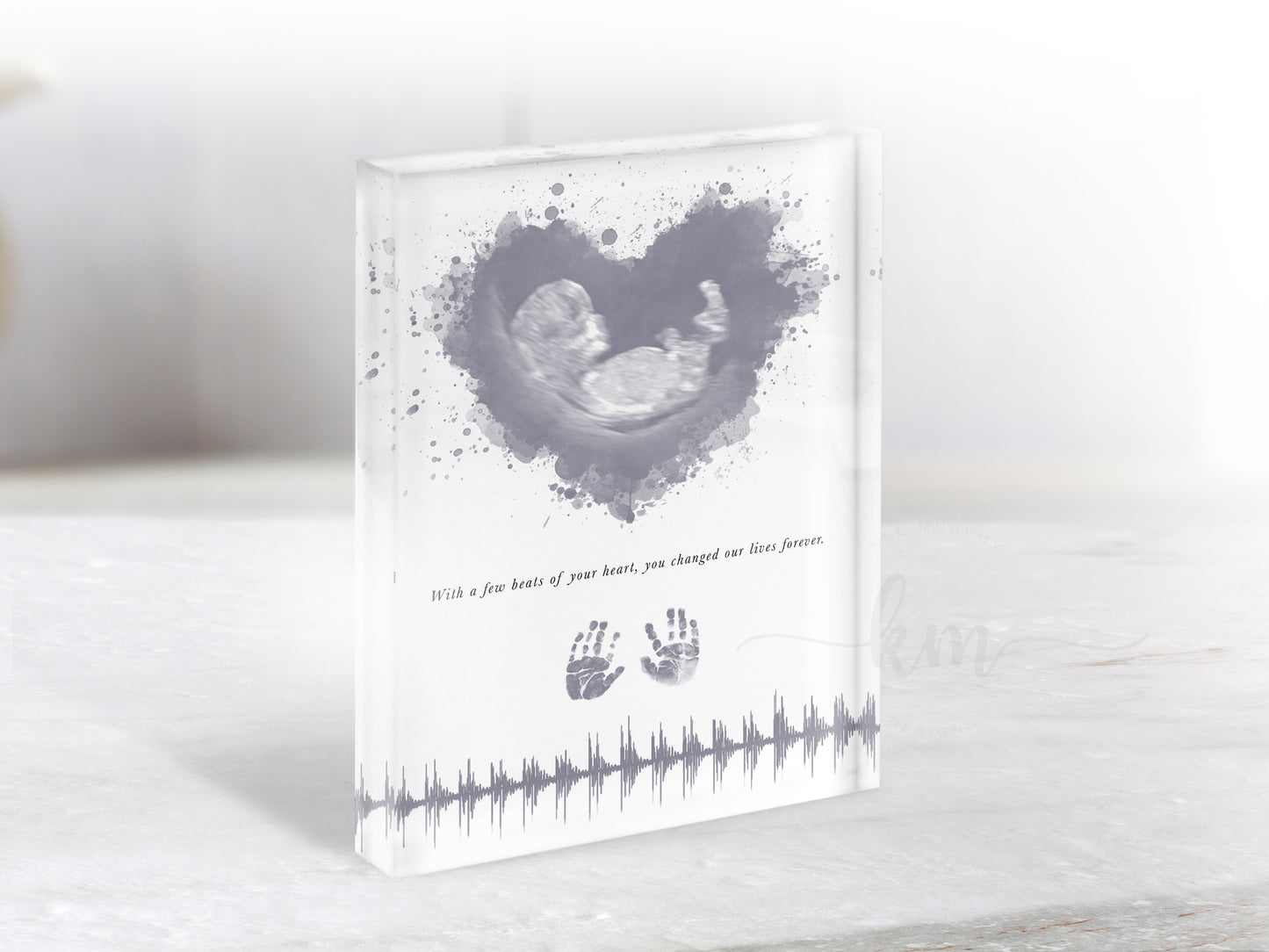 Ultrasound art print for pregnancy or infant loss with handprints, name and verse option