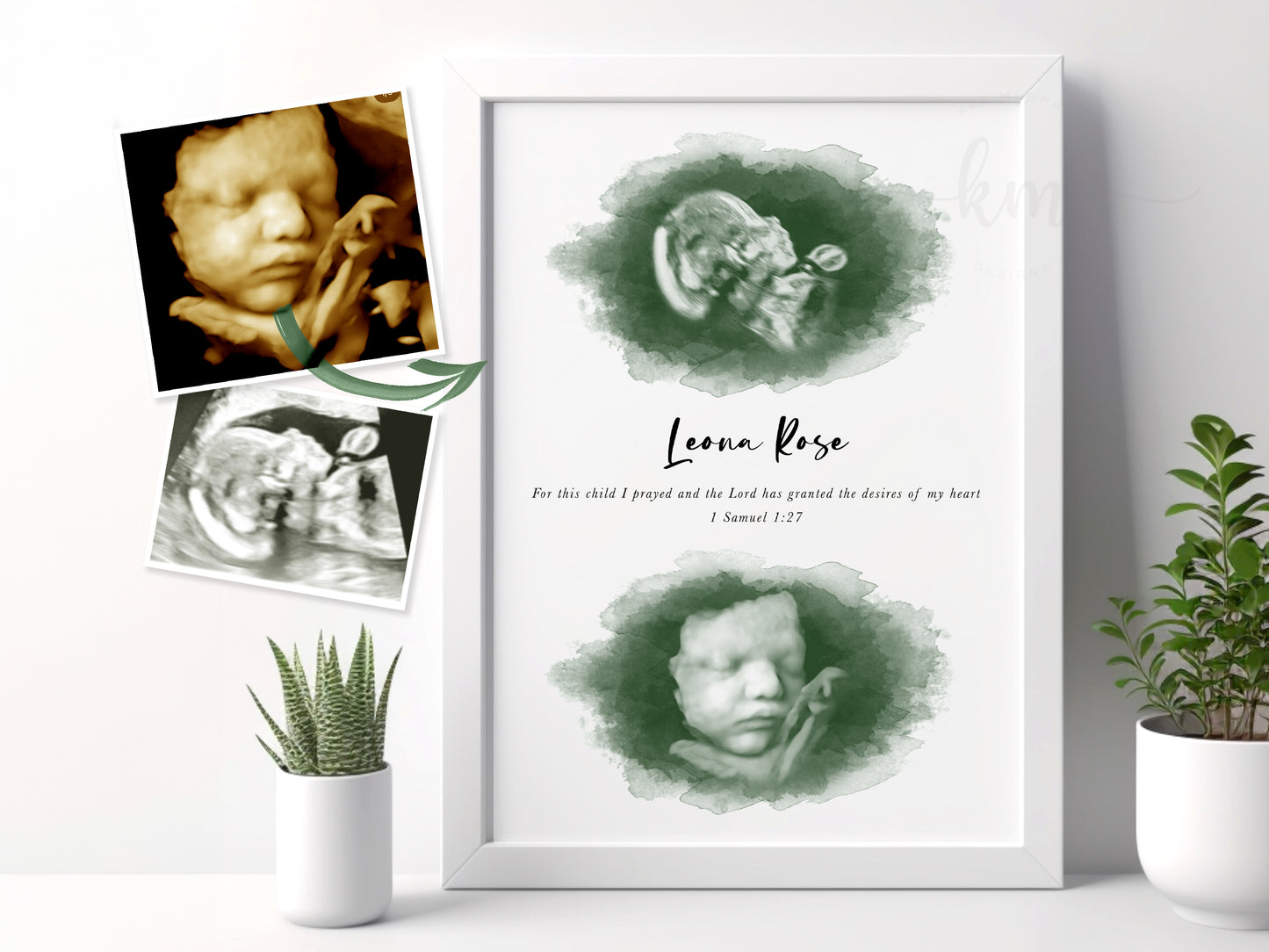 Custom watercolor twins ultrasound art with baby names and stats