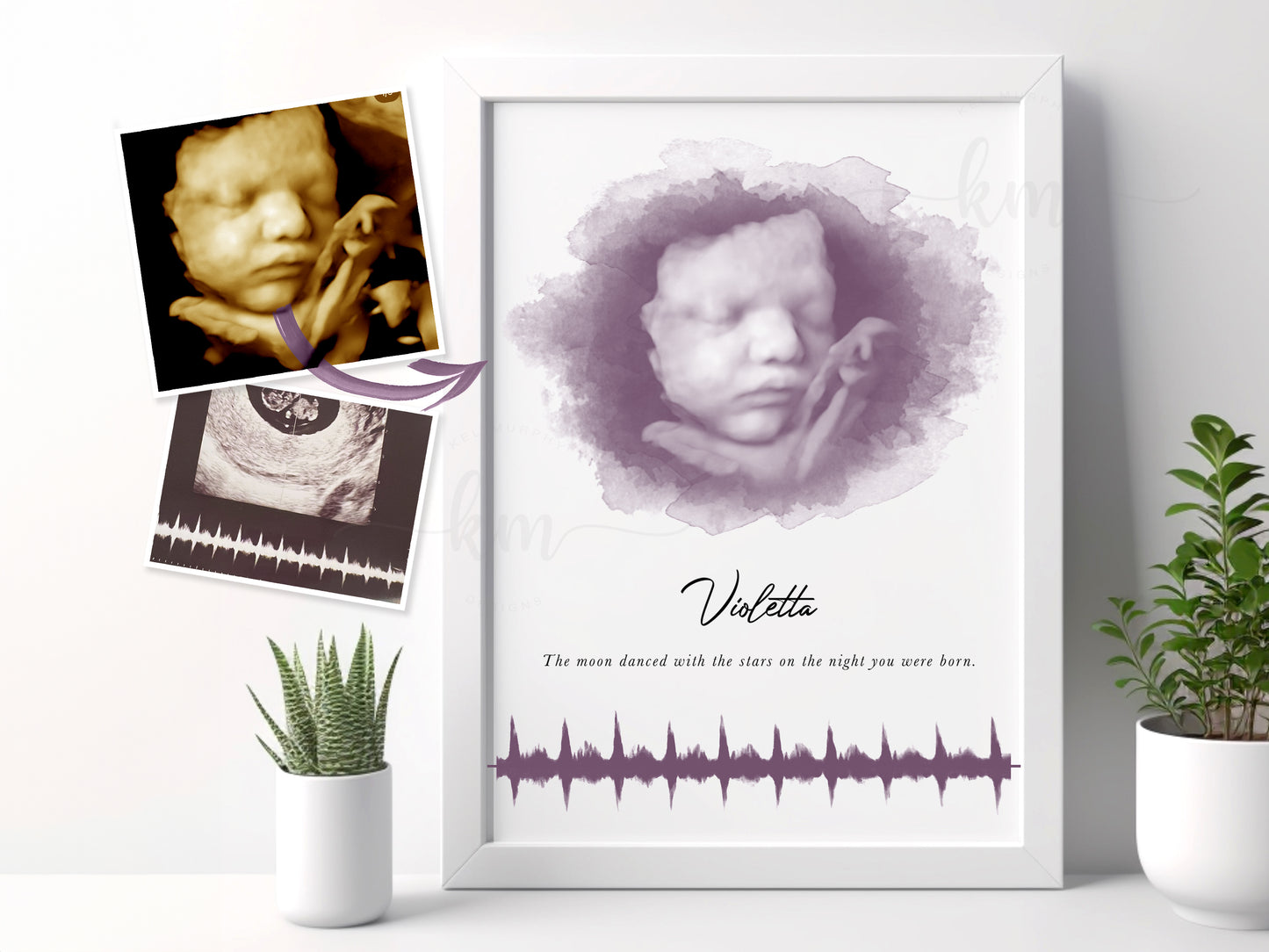 Oval Watercolor Ultrasound Art with Baby Heartbeat