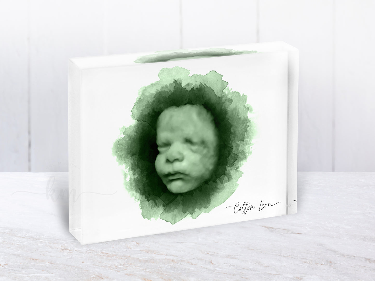Circle ultrasound keepsake print for honoring pregnancy loss or new mom gift
