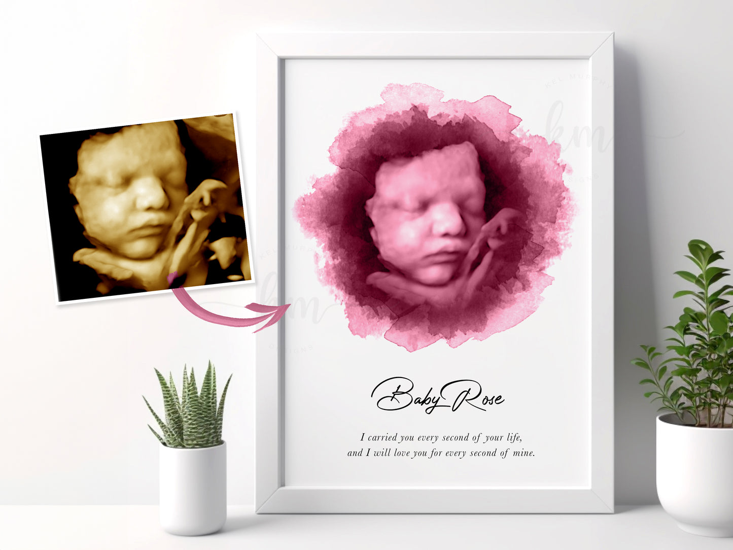 Hand-painted watercolor circle ultrasound print for baby loss memorial