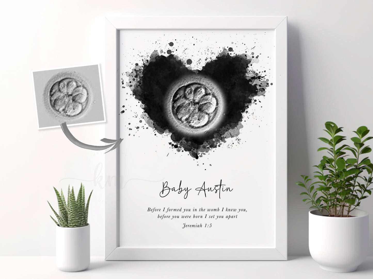 IVF embryo watercolor keepsake for miscarriage or rainbow baby gift