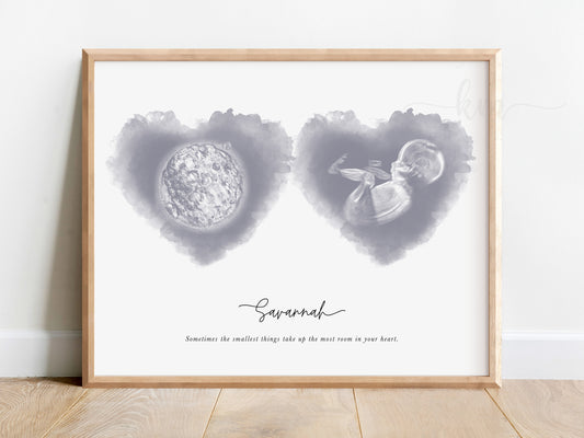 Two hearts watercolor art featuring ultrasound and embryo for IVF baby gift