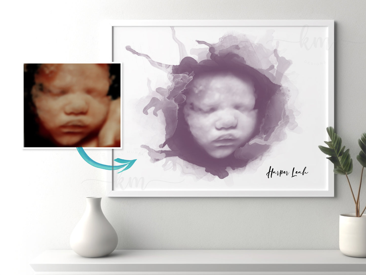 Alcohol ink style sonogram artwork for new mom or pregnancy loss
