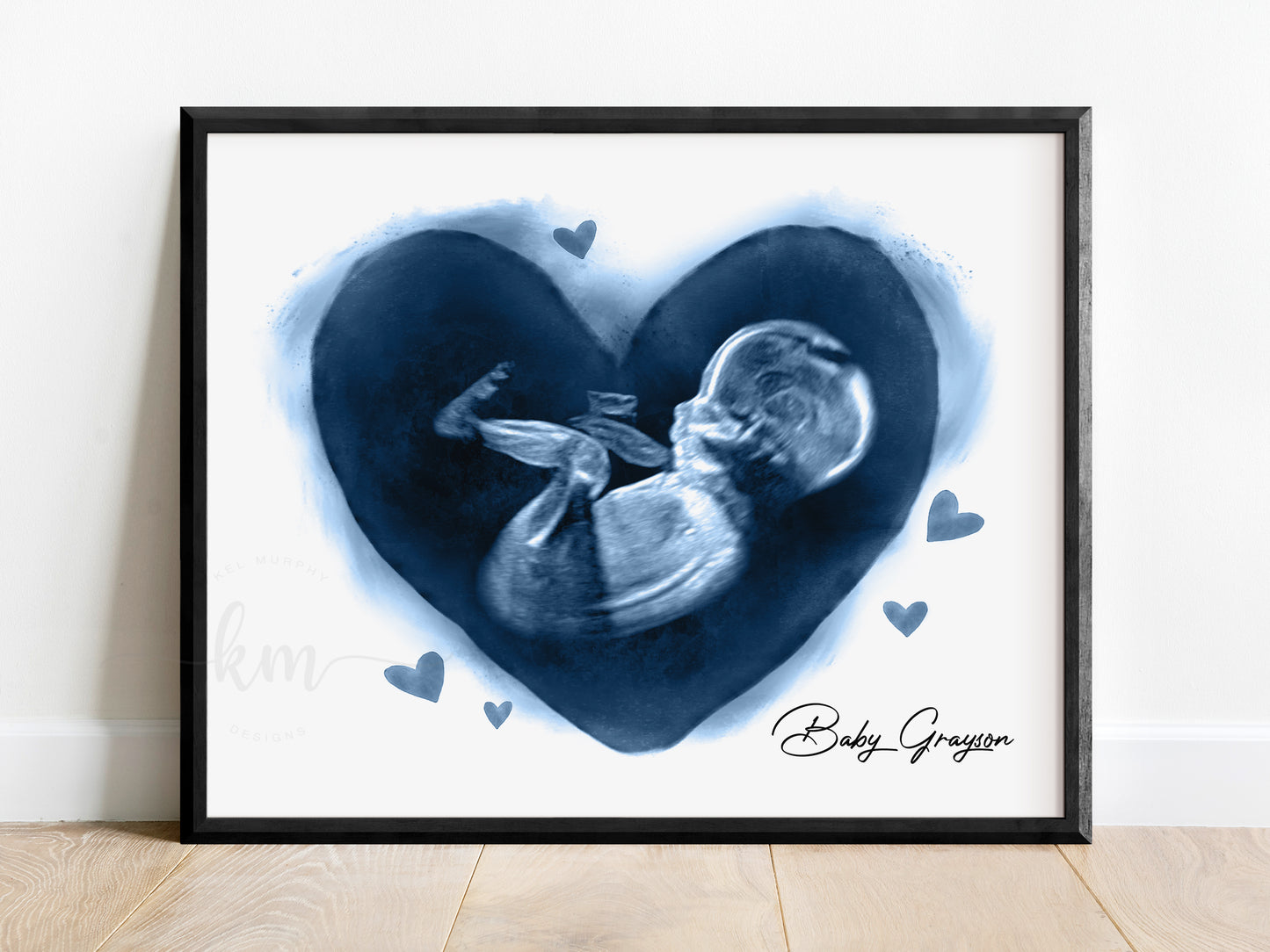 Hearts ultrasound art for miscarriage or baby loss memorial