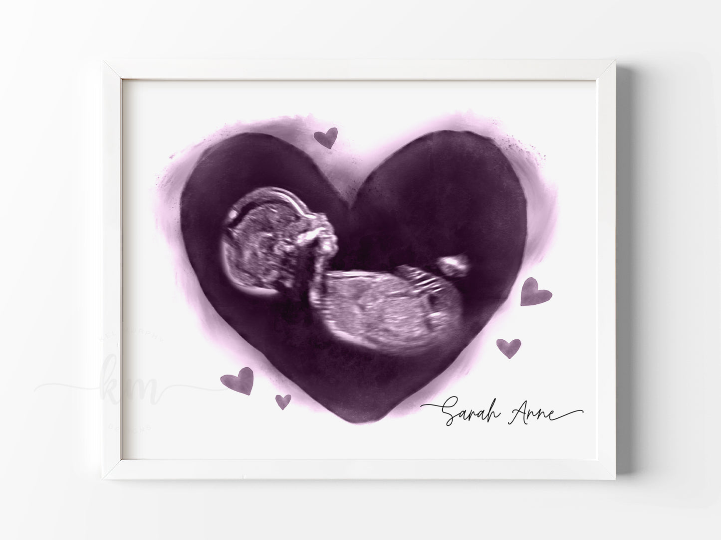 Personalized hearts ultrasound art for pregnancy loss keepsake