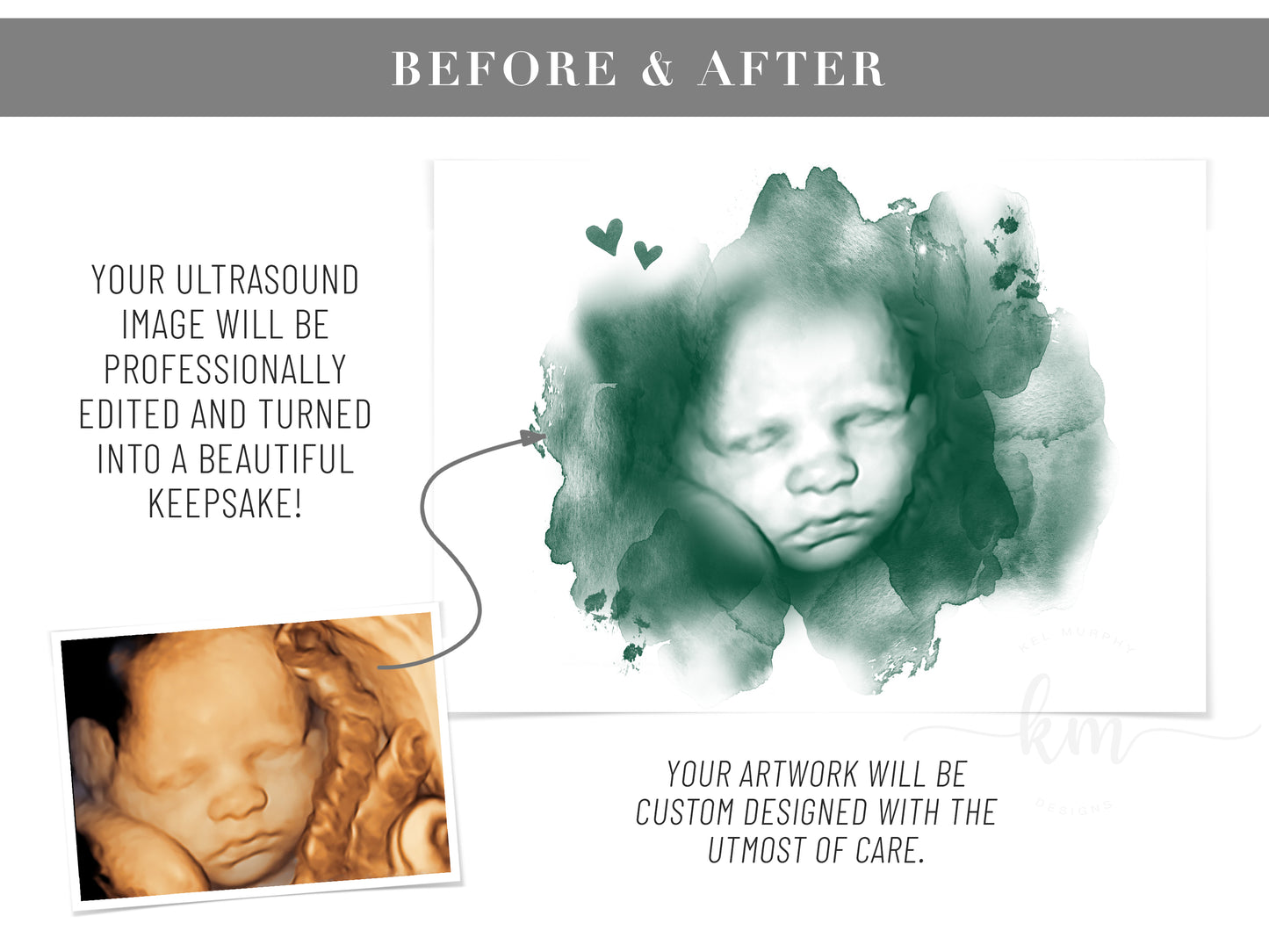 Ultrasound art with baby's name – miscarriage remembrance gift