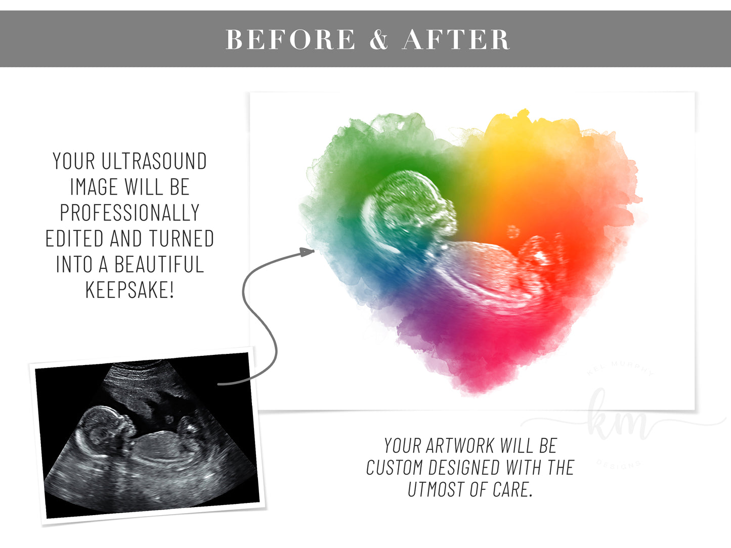 Baby loss memorial with rainbow heart and ultrasound photo – personalized keepsake art