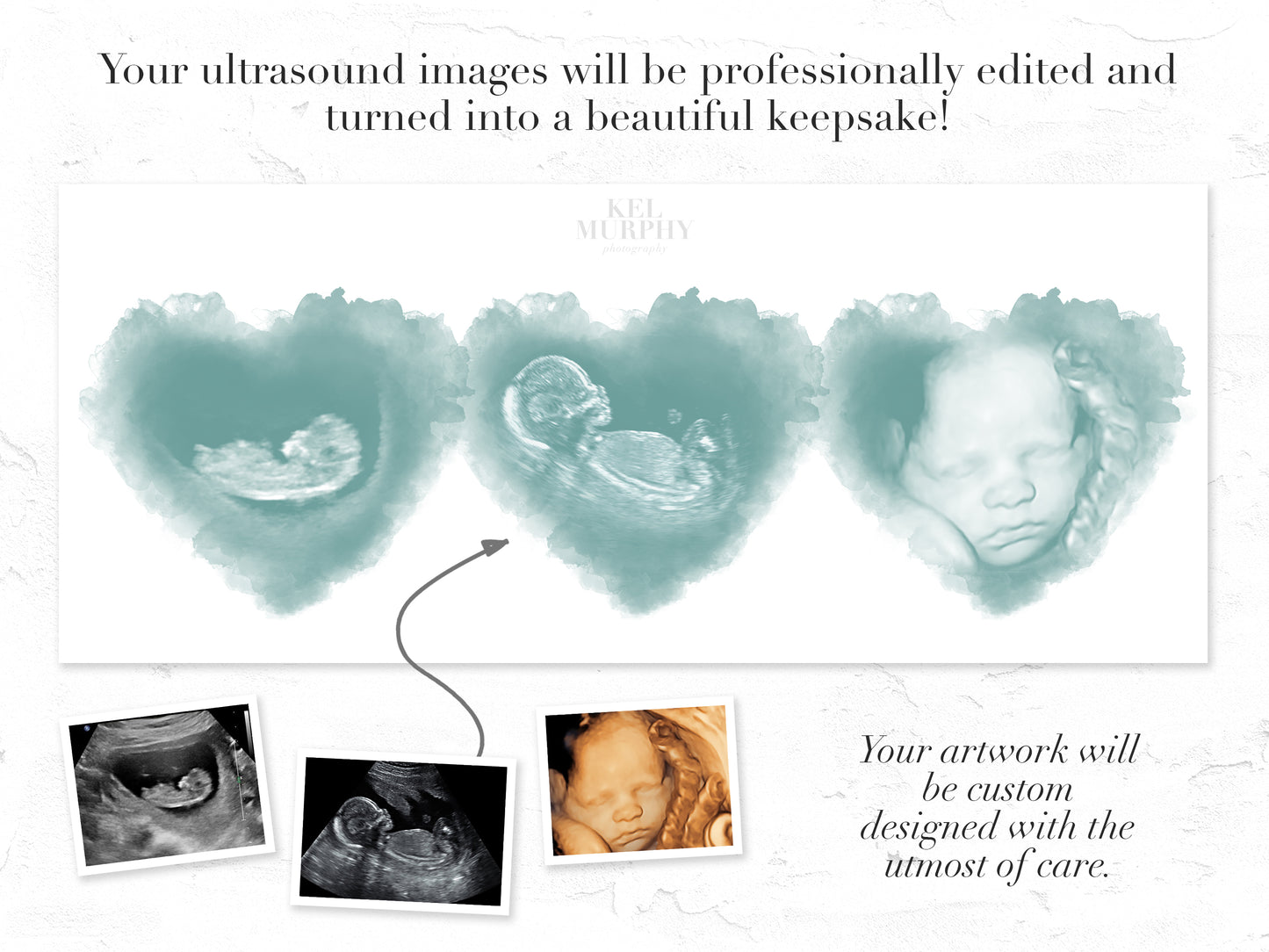 Custom three-heart ultrasound art for miscarriage or new mom gift