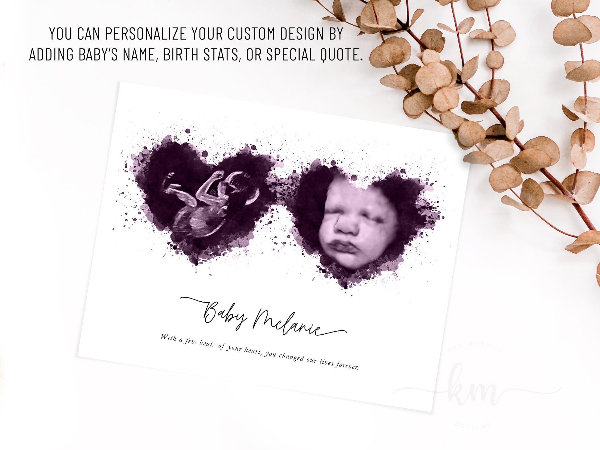 Custom twin ultrasound print with watercolor heart design for memorial or celebration

