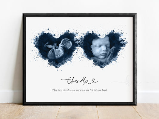 Two Splatter Hearts Ultrasound Art
