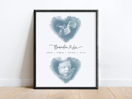 Two Hearts Watercolor Ultrasound Art (Vertical)