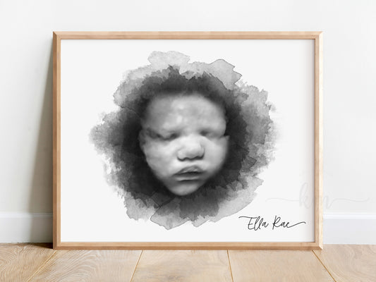 Circle 3D Ultrasound Art