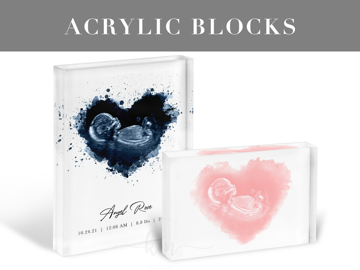 LOVED Watercolor 3D Ultrasound Art