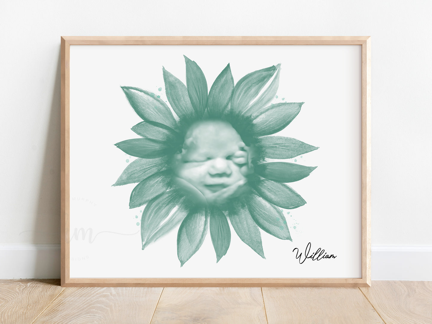 Custom ultrasound artwork with sunflower watercolor design

