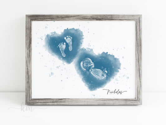 Watercolor ultrasound and handprint or footprint art for baby loss or miscarriage gift


