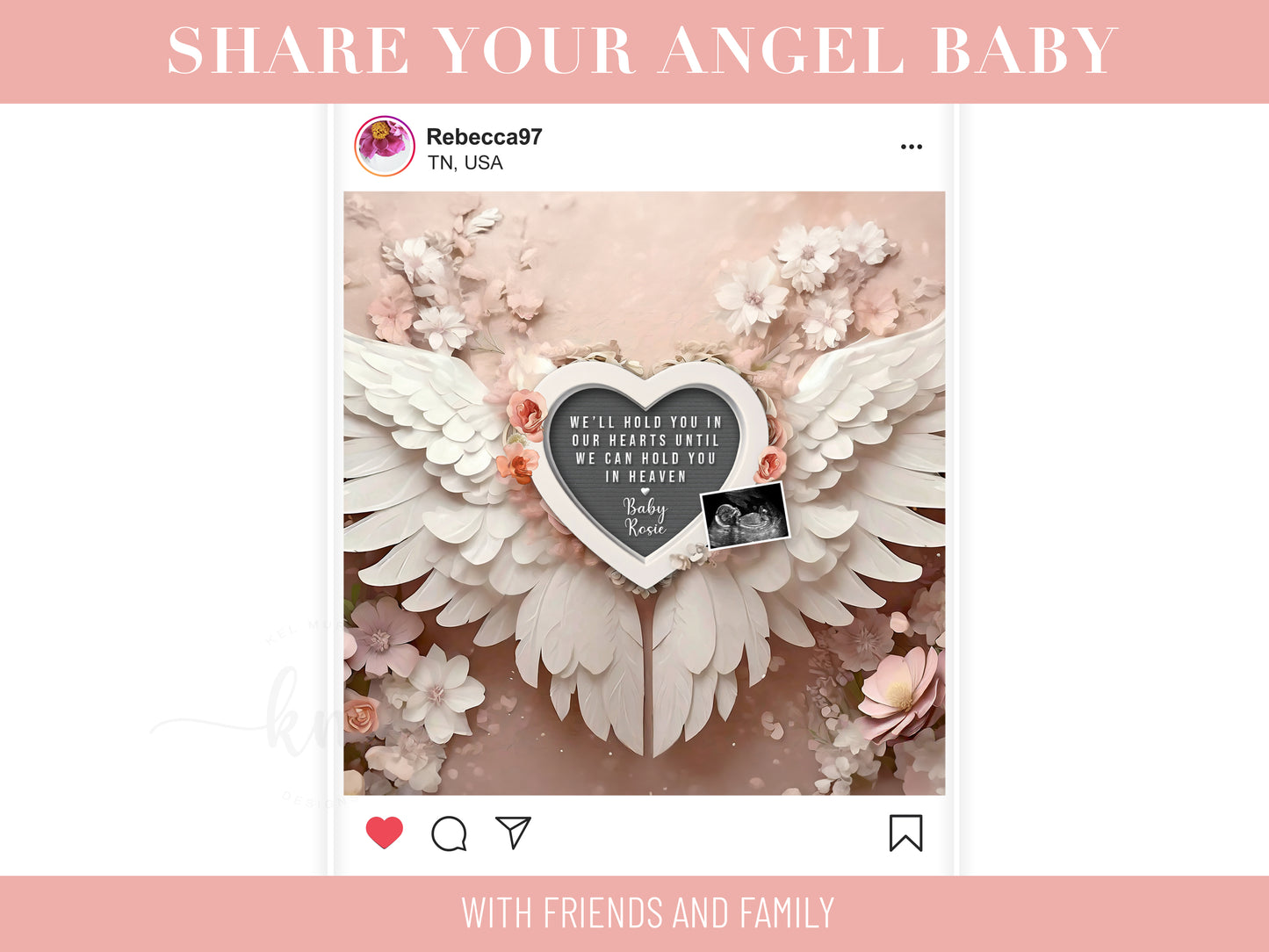 Personalized baby loss announcement featuring ultrasound and custom wording for remembrance

