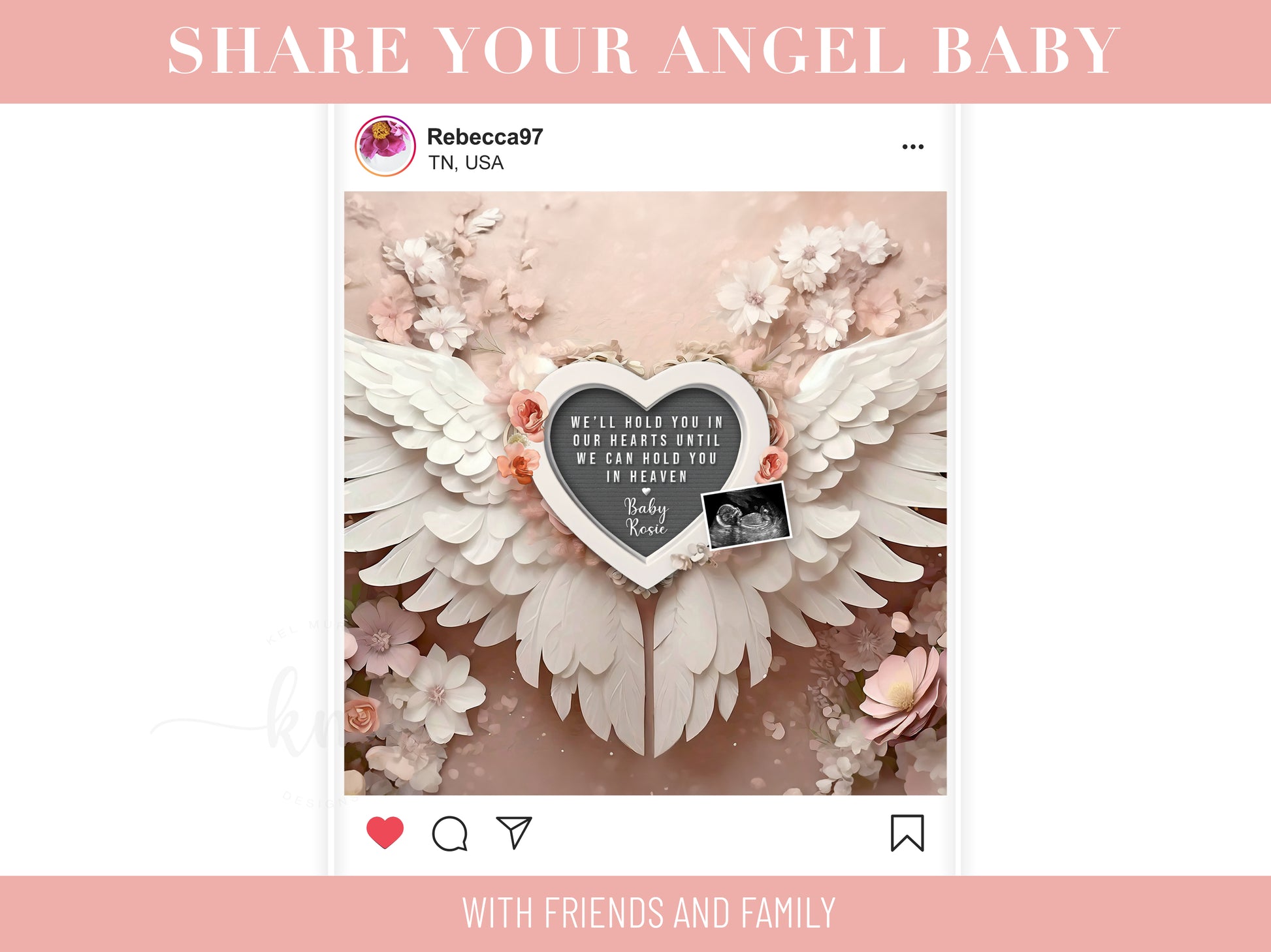 Personalized baby loss announcement featuring ultrasound and custom wording for remembrance

