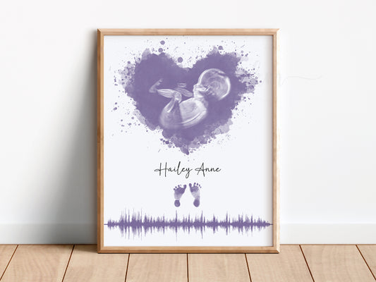 Watercolor ultrasound keepsake with heartbeat and footprints, baby loss memorial

