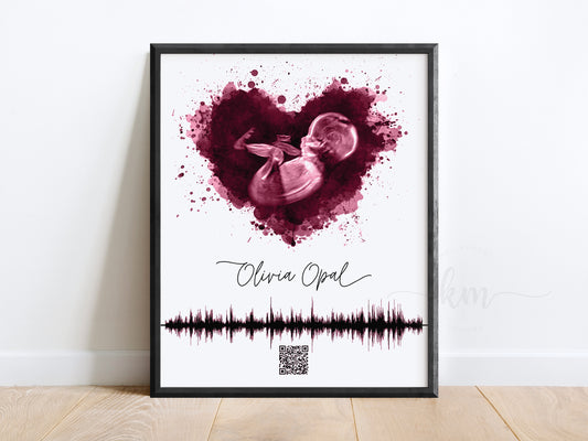 Splatter Heart Ultrasound Art with Baby Heartbeat & QR Code