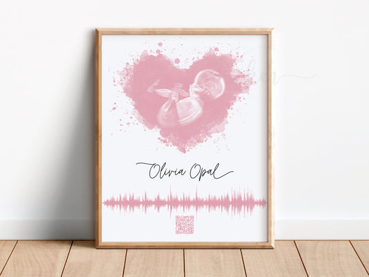 Splatter Heart Watercolor Ultrasound Art with Baby Heartbeat & QR Code